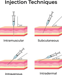 Different Injection Techniques Intramuscular Subcutaneous Intravenous and Intradermal