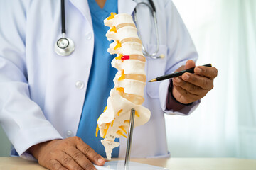 Doctor with lumbar vertebra bone skeleton and nerve model for treatment in the orthopedic...