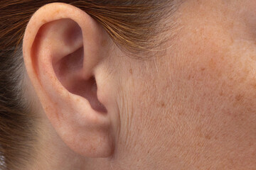 Preauricular wrinkles in front of ears on woman face