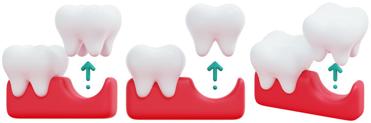 Set of 3D Illustration of Tooth Extraction and Stitching Process 3d Render Icon Illustration