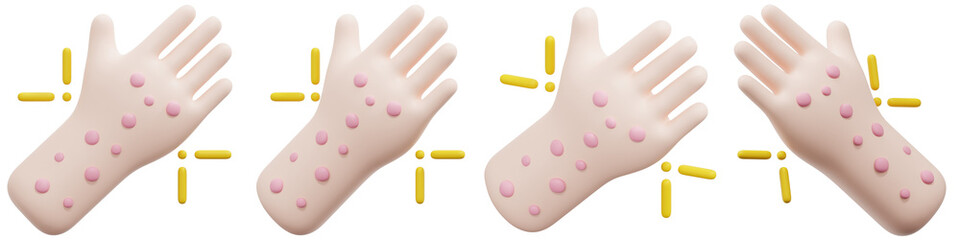 Set of Digital Illustration of Hands with Urticaria Skin Rash 3d Render Icon Illustration