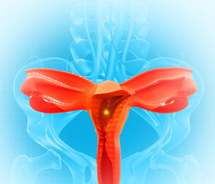 Dilation and curettage (d and c).endometrial biopsy.cervical cancer.3d illustration