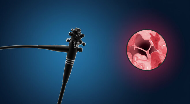 The Endoscopy Procedure A Visual Journey Inside the Human Body Revealing Internal Organs and Structures