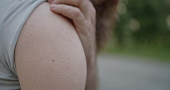 A man rubs his itchy arm, possibly due to an allergic reaction, skin irritation, or a bug bite, while outdoors.