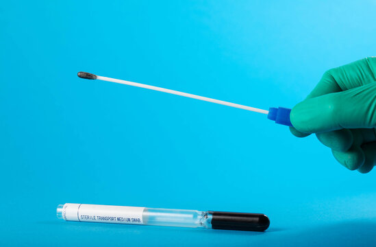 The doctor holds a sterile probe for a smear on a blue background, worms. Treatment of roundworms and pinworms. Copy space for text, vermicularis, parasites