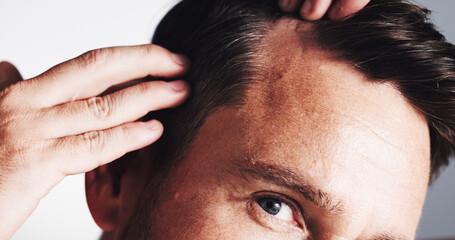 Hairline, growth and closeup with man in studio for scalp inspection, beauty and alopecia...