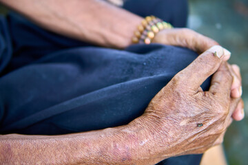 Close-up of Aged Hands with Wrinkles and Insect on Skin, Symbol of Aging and Simplicity