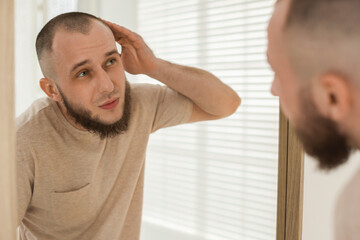 Baldness problem. Man with receding hairline near mirror at home