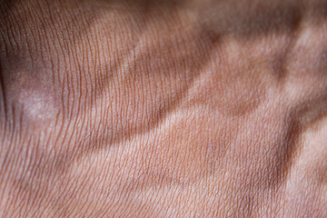 Naklejka premium Man's leg skin texture with visible veins. The skin background of the man's legs is brown