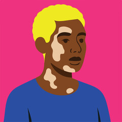  vector illustration of black boy with vitiligo