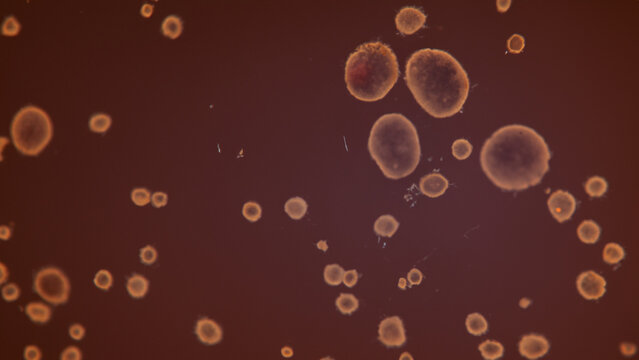 Microscopic view of cells or microorganisms suspended in a dark liquid medium - Powered by Adobe