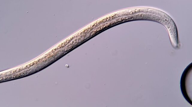 Movement of nematode larvae under microscope, 400x