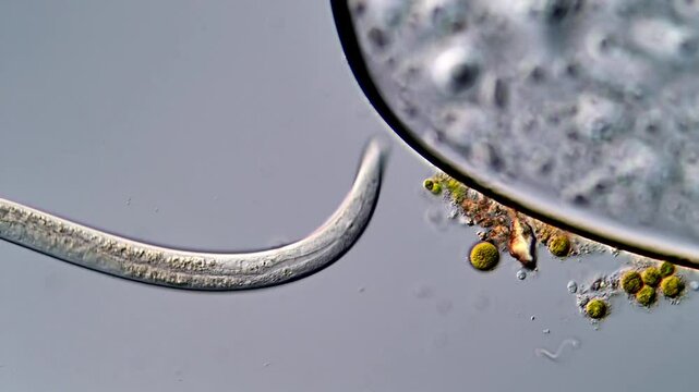 Movement of nematode larvae under microscope, 400x