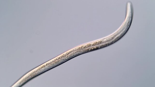 Movement of freshwater nematode under DIC microscope, 400x