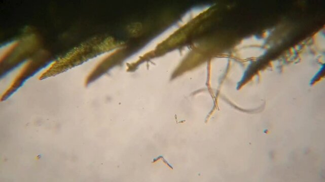 A moving nematode under a microscope.	