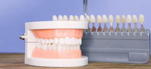 Dental prosthetic model with tooth shade guide