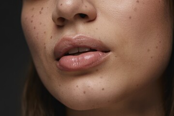 Naklejka premium Close-up of a woman's face highlighting natural beauty and freckles, exuding confidence and elegance.