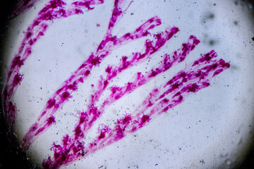 Bugula bryozoan colony under microscope showing branching zooid
