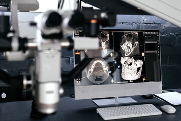 Microscope in dentistry on the background of the screen with images of the jaw. Concept of modern dental technology.