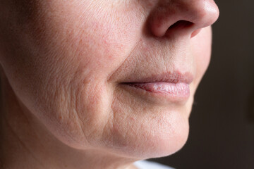 Realistic close-up of a senior woman's lower face with pronounced wrinkles and skin texture. Ideal...