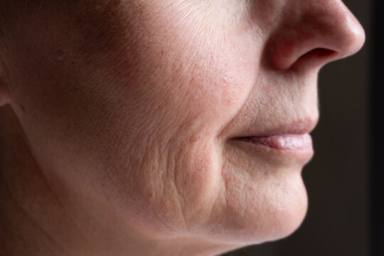 Detailed close-up of a senior woman's cheek and jaw area with visible fine lines, sagging skin, and age texture. Ideal for anti-aging, skincare, or dermatology visuals.