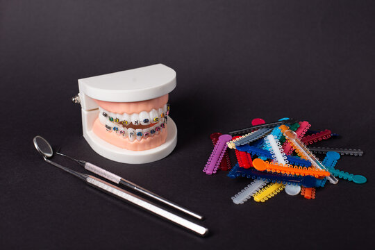 Orthodontic ligatures rings and ties, elastic rubber bands on orthodontic braces, model for dentist studying about dentistry.