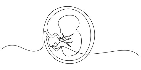 Baby embryo in womb one line drawing. Cute unborn fetus baby on mother womb isolated on white background, Baby embryo in womb in one continuous line drawing. Healthy pregnancy and premature symbol.
