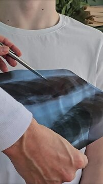 Doctor examines x-ray of patient's chest for diagnosis in medical consultation session