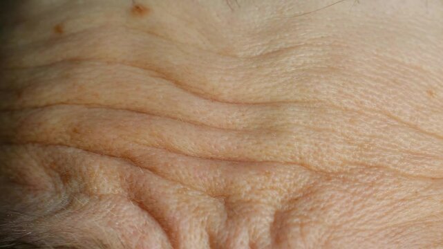 Close up view revealing gradual wrinkle reduction on forehead, demonstrating advanced skin rejuvenation and anti aging treatment effectiveness with remarkable dermatological transformation