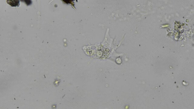 View of amoeba under magnification in a water sample, timelapse reveals complex motion in an unseen microscopic world.