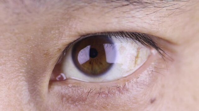 Chestnut color Asian eye