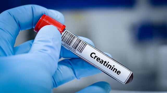 Blood sample tube for creatinine test analysis.