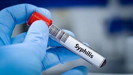 Blood sample tube for syphilis test analysis.