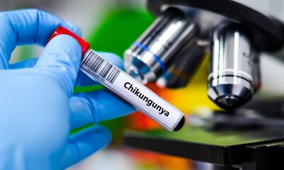Blood sample tube for chikungunya virus test analysis.