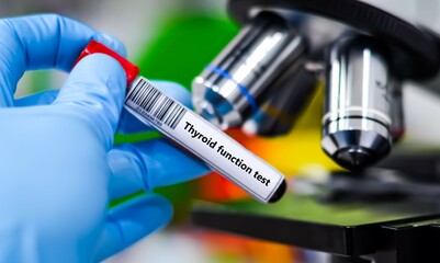 Blood sample tube for thyroid function test analysis.