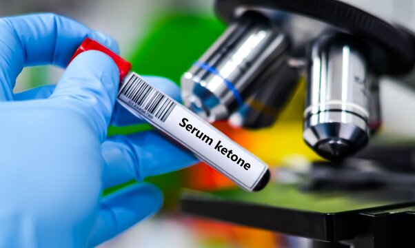 Blood sample tube for serum ketone test analysis.