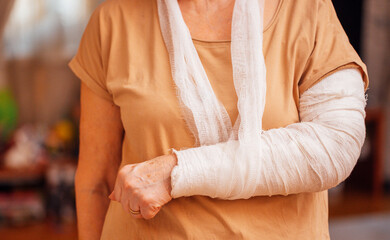 An elderly woman with a cast on her arm in the living room. A mature lady with a bandaged arm
