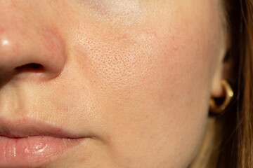 Detailed close-up of female cheek and nose showing enlarged pores, natural skin texture, and...