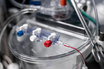 Cardiopulmonary Bypass Machine details, Blood reservoir during heart surgery, in the clean sterile...
