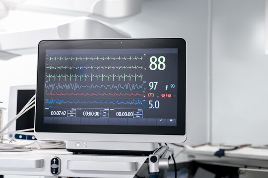 View on medical vital signs monitor in sterile white operating room in a hospital. Health care device displays heart rate, oxygen levels, pressure indicators. Medical equipment. High quality photo