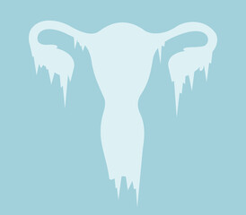 Frozen womb and uterus with frost and ice. Assisted reproduction and egg freezing as preservation and preserving the fertility of fertile woman and female. Vector illustration.