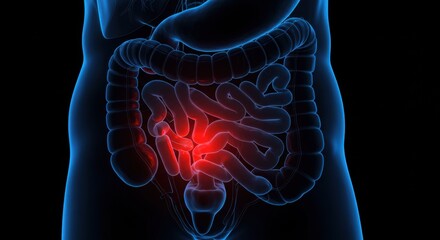 Detailed digital illustration of human digestive system highlighting intestinal inflammation and gastrointestinal health issues