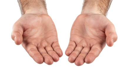 Close Up of Two Hands with Dry Flaky Skin on Transparent Background, PNG