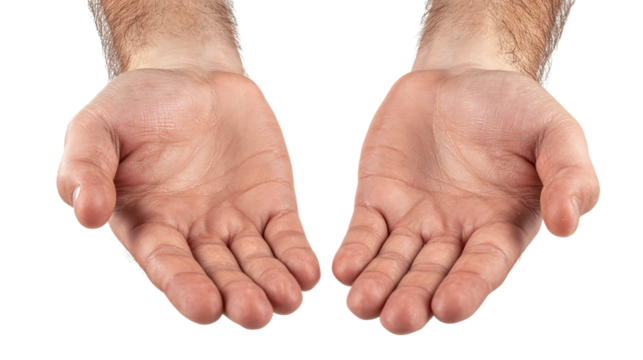 Close Up of Two Hands with Dry Flaky Skin on Transparent Background, PNG