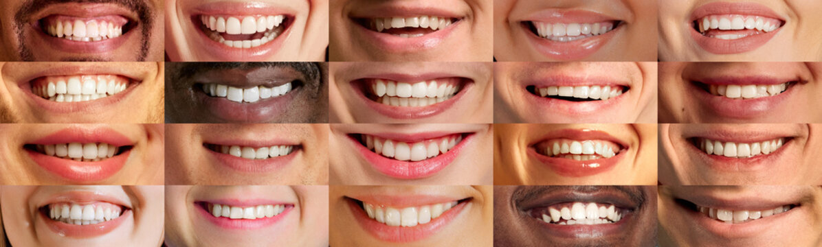 Grid collage of close-up smiles from diverse individuals, capturing joy and emotion. Concept of human diversity, emotions, equality,hygiene, health, care, happiness, personality.