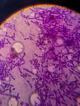 Purple-stained bacilli bacteria viewed under light microscop