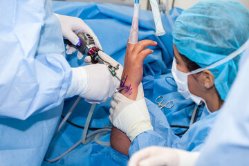 Group of surgeons performing an orthopedic surgery. Female doctor performing a surgery. Orthopedic...