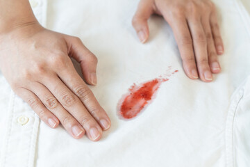 Prepare before laundry, Stain of jam on the white shirt.