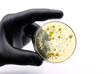 Doctor's or scientist's hand with a microbiological culture dish with colonies of bacteria 