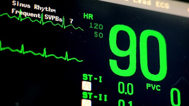 close-up ekg heart monitor flatline hospital machine ecg black and green line pulse.